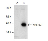 NHLRC2 (K-18): sc-240737. Western blot analysis of NHLRC2 expression in non-transfected: sc-117752 (A) and human NHLRC2 transfected: sc-115266 (B) 293T whole cell lysates.