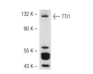 TTI1 (N-19): sc-85605. Western blot analysis of TTI1 expression in HeLa whole cell lysate.