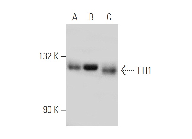 TTI1 (N-19): sc-85605. Western blot analysis of TTI1 expression in non-transfected 293T: sc-117752 (A), human TTI1 transfected 293T: sc-113814 (B) and Jurkat (C) whole cell lysates.