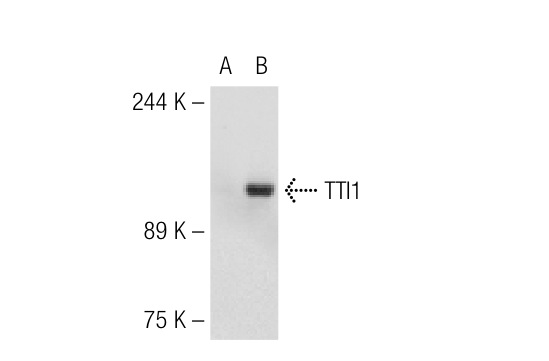 TTI1 (N-19): sc-85605. Western blot analysis of TTI1 expression in non-transfected: sc-110760 (A) and human TTI1 transfected: sc-113814 (B) 293 whole cell lysates.