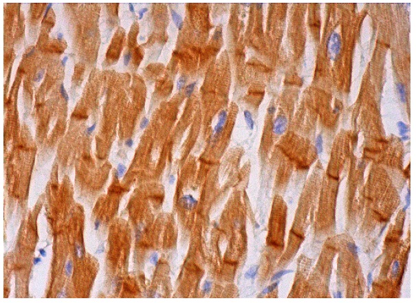 TTI1 (N-19): sc-85605. Immunoperoxidase staining of formalin fixed, paraffin-embedded human heart muscle tissue showing cytoplasmic and intercalated disc staining of myocytes.