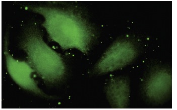 TXNDC9 (39-R): sc-100599. Immunofluorescence staining of paraformaldehyde-fixed HeLa cells showing cytoplasmic localization.