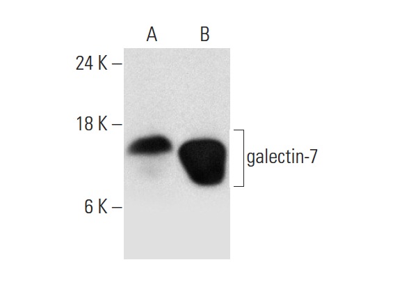 galectin-7 (F-3): sc-271472. Western blot analysis of galectin-7 expression in human cervix tissue extract (A) and SCC-4 whole cell lysate (B).
