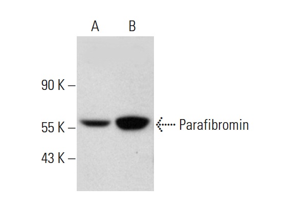 Parafibromin (E-4): sc-373792. Western blot analysis of Parafibromin expression in C32 whole cell lysate (A) and HeLa nuclear extract (B).