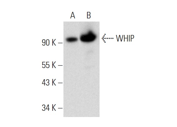 WHIP (G-2): sc-377402. Western blot analysis of WHIP expression in IMR-32 (A) and Jurkat (B) nuclear extracts.