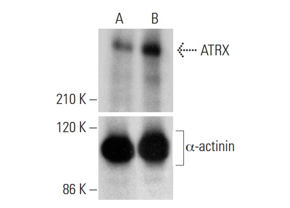 ATRX CRISPR Activation Plasmid (h): sc-400454-ACT. Western blot analysis of ATRX expression in non-transfected control (A) and ATRX CRISPR Activation Plasmid transfected (B) HEK293TN whole cell lysates. Blot probed with ATRX (D-5): sc-55584. α-actinin (C-2): sc-17829 used as specificity and loading control.