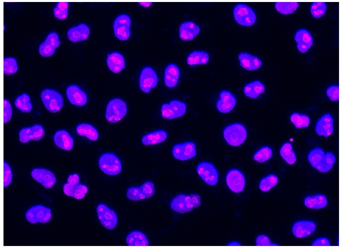 donkey anti-rabbit IgG-CFL 647: sc-362291. Immunofluorescence staining of formalin-fixed HeLa cells showing nucleolar localization and nuclear DAPI counterstain. Antibody tested: C23 (H-250): sc-13057. Donkey anti-rabbit IgG was conjugated to CruzFluor™ 647 succinimidyl ester: sc-362620. Kindly provided by Yang Xiang, Ph.D., Division of Newborn Medicine, Boston Childrens Hospital, Cell Biology Department, Harvard Medical School.