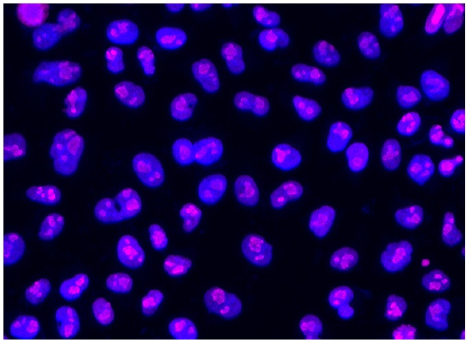 goat anti-rabbit IgG-CFL 647: sc-362292. Immunofluorescence staining of formalin-fixed HeLa cells showing nucleolar localization and nuclear DAPI counterstain. Antibody tested: C23 (H-250): sc-13057. Goat anti-rabbit IgG was conjugated to CruzFluor™ 647 succinimidyl ester: sc-362620. Kindly provided by Yang Xiang, Ph.D., Division of Newborn Medicine, Boston Childrens Hospital, Cell Biology Department, Harvard Medical School.