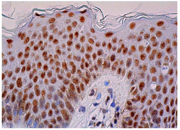 MBD2 (C-11): sc-514062. Immunoperoxidase staining of formalin fixed, paraffin-embedded human skin tissue showing nuclear staining of keratinocytes, fibroblasts and melanocytes.