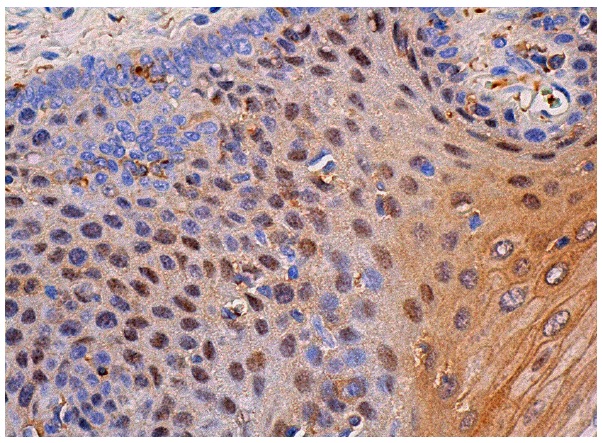 MBD2 (C-11): sc-514062. Immunoperoxidase staining of formalin fixed, paraffin-embedded human oral mucosa tissue showing nuclear and cytoplasmic staining of squamous epithelial cells.
