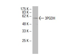 3PGDH (6B2): sc-100317. Western blot analysis of 3PGDH expression in human liver tissue extract.