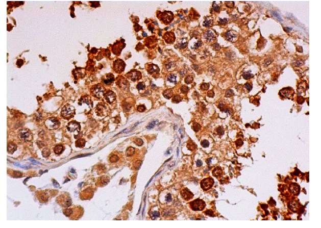 Reptin 52 (N-20): sc-34751. Immunoperoxidase staining of formalin fixed, paraffin-embedded human testis tissue showing nuclear and cytoplasmic staining of cells in seminiferous ducts and Leydig cells.