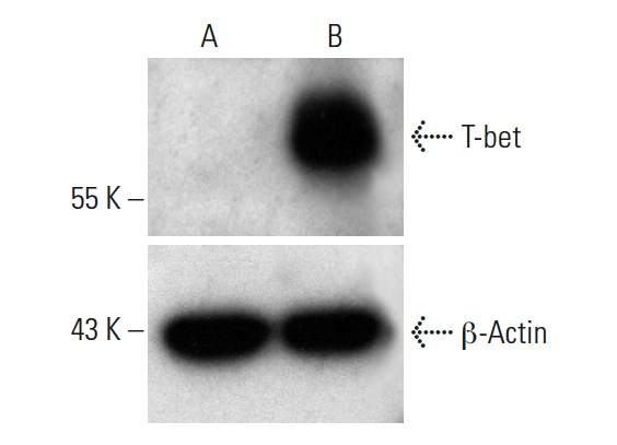 T-bet CRISPR Activation Plasmid (h): sc-400480-ACT. Western blot analysis of T-bet expression in non-transfected control (A) and T-bet CRISPR Activation Plasmid transfected (B) HEK293T whole cell lysates. Blot probed with T-bet (A-18): sc-21003. β-actin (C4): sc-47778 used as specificity and loading control.