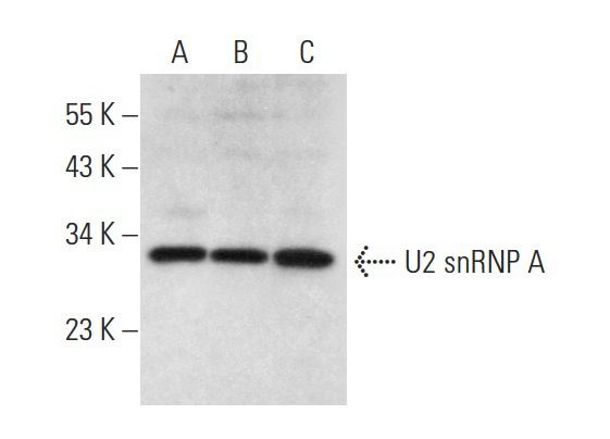 U2 snRNP A (D-12): sc-132132. Western blot analysis of U2 snRNP A expression in HUV-EC-C (A), Hep G2 (B) and HeLa (C) whole cell lysates.