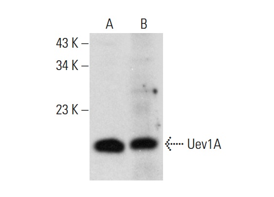Uev1A (H-6): sc-390047. Western blot analysis of Uev1A expression in CCRF-CEM whole cell lysate (A) and human pancreas tissue extract (B).