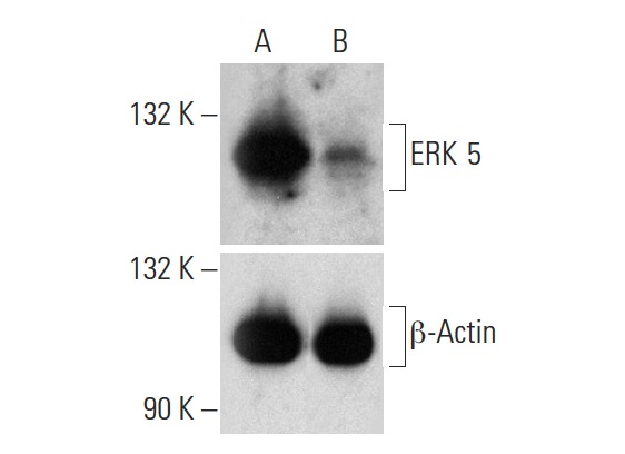 ERK 5 HDR Plasmid (h): sc-400891-HDR. Western blot analysis of ERK 5 expression in non-transfected control (A) and puromycin treated, ERK 5 CRISPR/Cas9 KO Plasmid: sc-400891 plus ERK 5 HDR Plasmid co-transfected (B) HEK 293T whole cell lysates. Blot probed with ERK 5 (C-20): sc-1284. β-Actinin (C4): sc-17829 used as specificity and loading control.