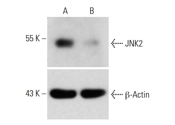 JNK2 CRISPR/CAS9 KO Plasmid (h): sc-400115. Western empty vector control (A) and JNK2 CRISPR/CAS9 KO Plasmid transfected (B) HEK293T whole cell lysates. Blot probed with JNK2 (L-12): sc-46013. β-actin (C4): sc-47778 used as specificity and loading control.