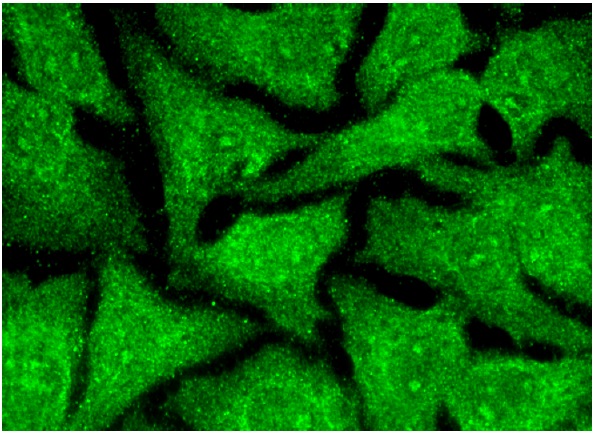 PAFAH1B2 (A-6): sc-393216. Immunofluorescence staining of methanol-fixed HeLa cells showing cytoplasmic, nuclear and nucleolar localization.