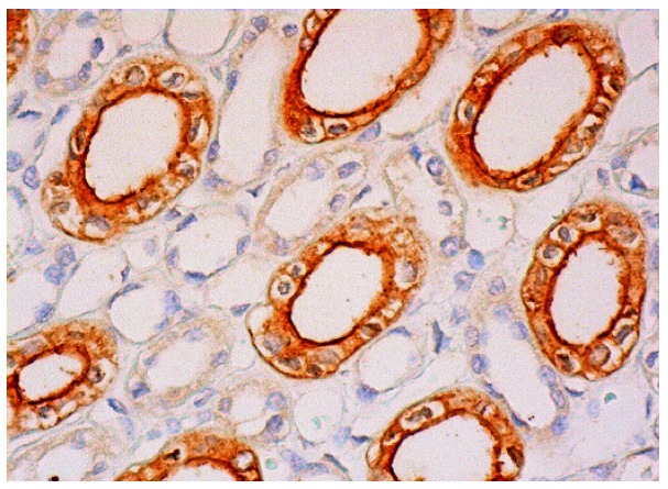 DcR2 (D-15): sc-11638. Immunoperoxidase staining of formalin fixed, paraffin-embedded human kidney tissue showing membrane and cytoplasmic staining of cells in tubules.