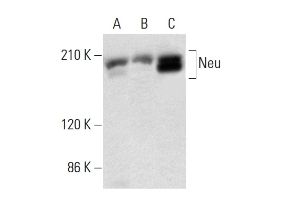 Neu (F-11): sc-7301. Western blot analysis of Neu expression in NIH/3T3 (A), HEL 92.1.7 (B) and SK-BR-3 (C) whole cell lysates.