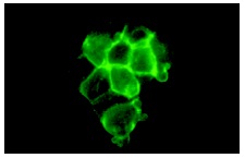 NGFR p75 (C-20): sc-6188. Immunofluorescence staining of methanol-fixed SK-N-MC cells showing membrane localization.