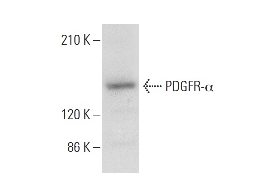 PDGFR-α (951): sc-431. Western blot analysis of PDGFR-α expression in HEK293 whole cell lysate.