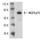 NGFR p75 (C-20): sc-6188. Western blot analysis of NGFR p75 expression in SK-N-MC whole cell lysate.