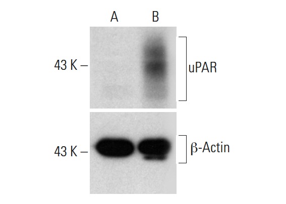 uPAR CRISPR Activation Plasmid (h): sc-400666-ACT. Western blot analysis of uPAR expression in non-transfected control (A) and uPAR CRISPR Activation Plasmid transfected (B) HEK293T whole cell lysates. Blot probed with uPAR (E-3): sc-376494. β-actin (C4): sc-47778 used as specificity and loading control.