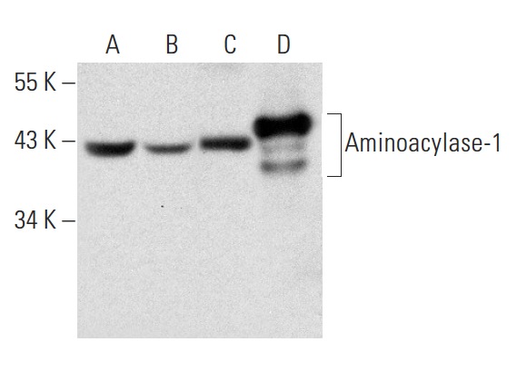 Aminoacylase-1 (B-1): sc-271019. Western blot analysis of Aminoacylase-1 expression in Hep G2 (A) and SH-SY5Y (B) whole cell lysates and human hippocampus (C) and human lung (D) tissue extracts.