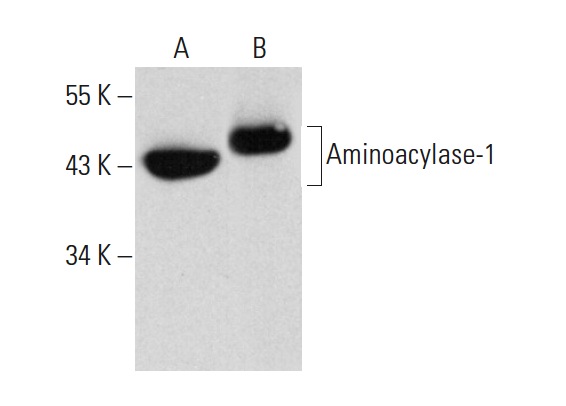 Aminoacylase-1 (B-1): sc-271019. Western blot analysis of Aminoacylase-1 expression in Hep G2 whole cell lysate (A) and human hippocampus tissue extract (B).