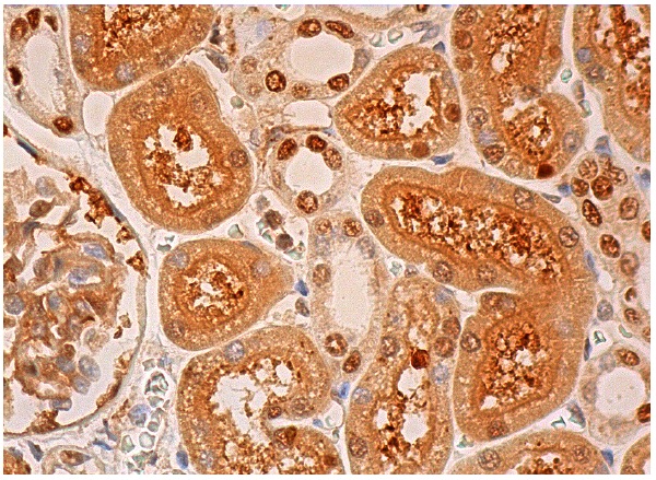 DcpS (A-12): sc-393226. Immunoperoxidase staining of formalin fixed, paraffin-embedded human kidney tissue showing cytoplasmic staining of cells in glomeruli and nuclear and cytoplasmic staining of cells in tubules.