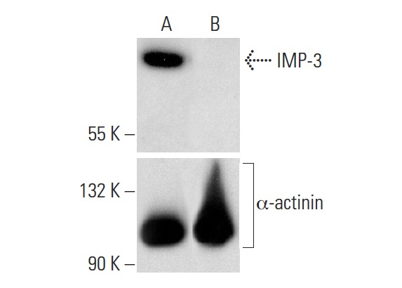 IMP-3 HDR Plasmid (h): sc-402603-HDR. Western blot analysis of IMP-3 expression in non-transfected control (A) and puromycin, IMP-3 CRISPR/Cas9 KO Plasmid: sc-402603 plus IMP-3 HDR Plasmid co-transfected (B) HEK 293T whole cell lysates. Blot probed with IMP-3 (E-2): sc-365640. α-actinin (H-2): sc-17829 used as specificity and loading control.