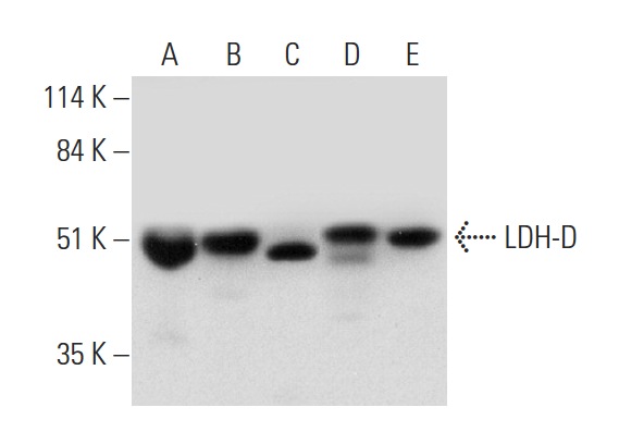 LDH-D (G-8): sc-374127. Western blot analysis of LDH-D expression in human heart (A), mouse heart (B), human skeletal muscle (C) and mouse skeletal muscle (D) tissue extracts and LADMAC whole cell lysate (E).