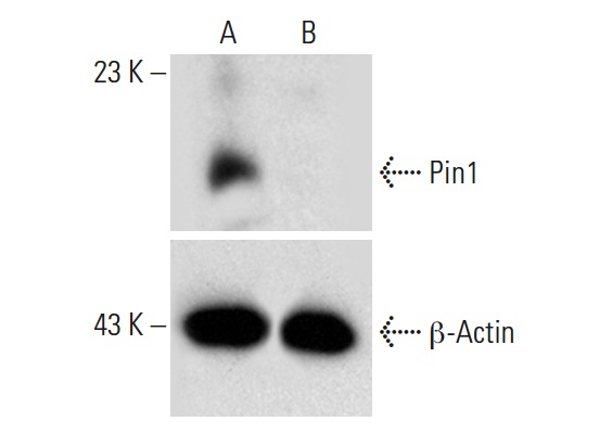 Pin1 HDR Plasmid (h): sc-400485-HDR. Western blot analysis of Pin1 expression in non-transfected control (A) and puromycin treated, Pin1 CRISPR/Cas9 KO Plasmid plus Pin1 HDR Plasmid co-transfected (B) HEK 293T whole cell lysates. Blot probed with Pin1 (H-123): sc-15340. -Actin (C4): sc-47778 used as specificity and loading control.