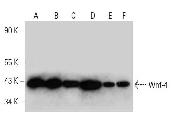 Wnt-4 (B-6): sc-376279. Western blot analysis of Wnt-4 expression in MCF7 (A), HeLa (B), SK-BR-3 (C) and HEK293 (D) whole cell lysates and human ovary (E) and human testis (F) tissue extracts.