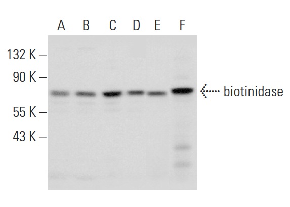 biotinidase (H-97): sc-368558. Western blot analysis of biotinidase expression in MOLT-4 (A), Jurkat (B), HeLa (C), NCI-H292 (D) and ACHN (E) whole cell lysates and mouse liver tissue extract (F).