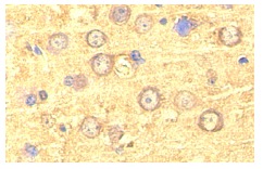 Nogo A (H-300): sc-25660. Immunoperoxidase staining of formalin fixed, paraffin-embedded mouse brain tissue showing cytoplasmic localization.