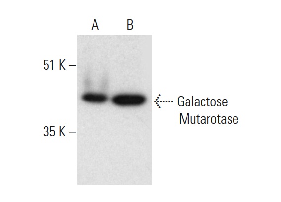 Galactose Mutarotase (C-4): sc-166471. Western blot analysis of Galactose Mutarotase expression in Hep G2 whole cell lysate (A) and human small intestine tissue extract (B).