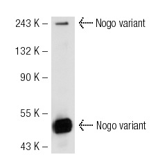 Nogo A (D-19): sc-11030. Western blot analysis of Nogo A expression in TE 671 whole cell lysate.