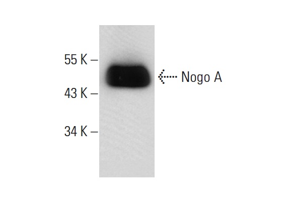 Nogo A (D-19): sc-11030. Western blot analysis of Nogo A expression in HeLa whole cell lysate.