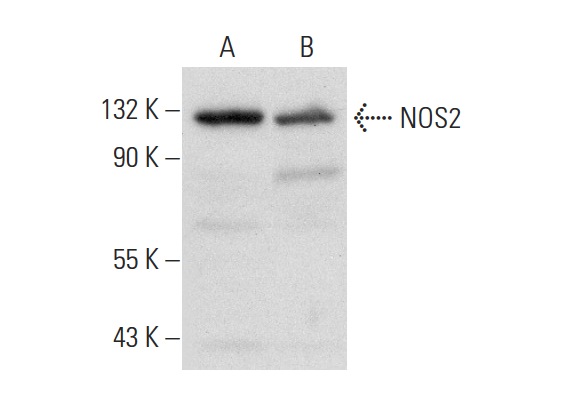 NOS2 (H-174): sc-8310. Western blot analysis of NOS2 expression in LPS/PMA-treated RAW 264.7 (A) and MCF7 (B) whole cell lysates.