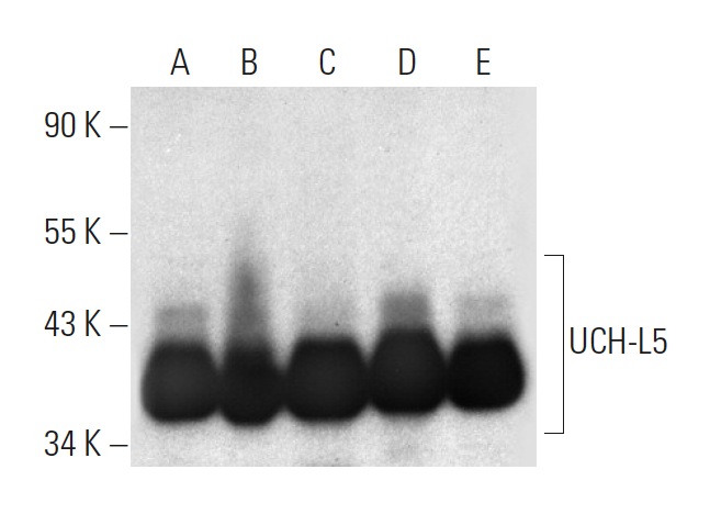 UCH-L5 (C-4): sc-271002. Western blot analysis of UCH-L5 expression in HEK293 (A), JAR (B), NCI-H460 (C), SH-SY5Y (D) and Hep G2 (E) whole cell lysates.