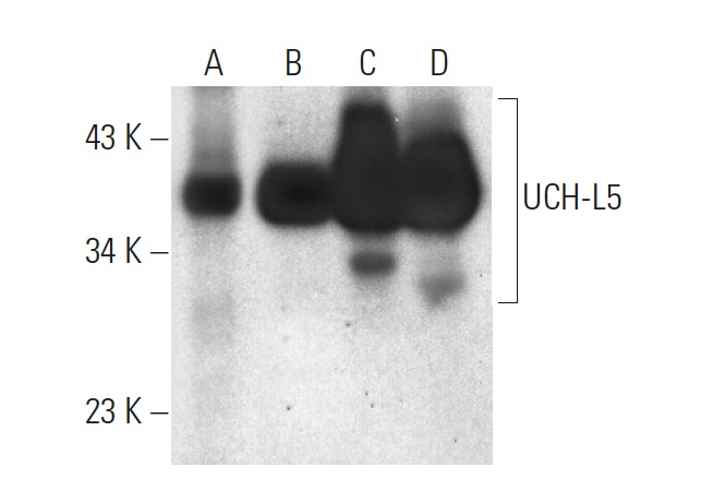 UCH-L5 (C-4): sc-271002. Western blot analysis of UCH-L5 expression in human placenta (A) and human liver (B) tissue extracts and K-562 (C) and HL-60 (D) whole cell lysates.