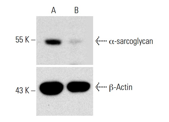 -sarcoglycan CRISPR/CAS9 KO Plasmid (m): sc-422904. Western blot analysis of -sarcoglycan expression in empty vector control (A) and -sarcoglycan CRISPR/CAS9 KO Plasmid transfected (B) NIH/3T3 whole cell lysates. Blot probed with -sarcoglycan (F-7): sc-390647. β-actin (C4): sc-47778 used as specificity and loading control.