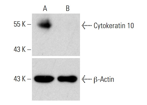 Cytokeratin 10 CRISPR/CAS9 KO Plasmid (h): sc-400193. Western blot analysis of Cytokeratin 10 expression in empty vector control (A) and Cytokeratin 10 CRISPR/CAS9 KO Plasmid transfected (B) HEK293T whole cell lysates. Blot probed with Cytokeratin 10 (VIK-10): sc-51581. β-actin (C4): sc-47778 used as specificity and loading control.