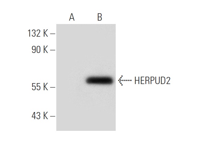 HERPUD2 (N-12): sc-164583. Western blot analysis of HERPUD2 expression in non-transfected: sc-117752 (A) and mouse HERPUD2 transfected: sc-120757 (B) 293T whole cell lysates.