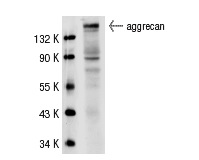 aggrecan/brevican (C-20): sc-16493. Western blot analysis of aggrecan/brevican expression in C6 whole cell lysate.