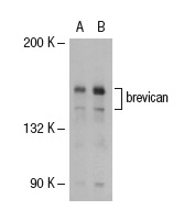 aggrecan/brevican (C-20): sc-16493. Western blot analysis of brevican expression in non-transfected: sc-117752 (A) and human brevican transfected: sc-113884 (B) 293T whole cell lysates.
