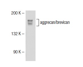 aggrecan/brevican (C-20): sc-16493. Western blot analysis of aggrecan/brevican expression in mouse heart tissue extract.