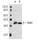 SMN (2B1): sc-32313. Western blot analysis of SMN expression in 293 (A), HeLa (B) and Jurkat (C) whole cell lysates.